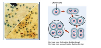 chondrocyty1